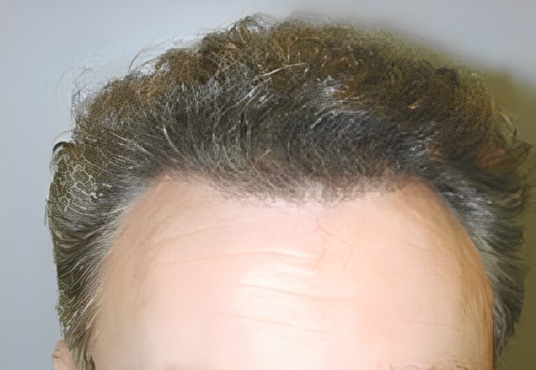 After Image: Patient 7 - front