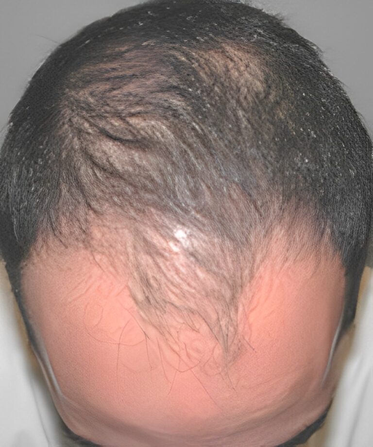 Before Image: Patient 8 - front