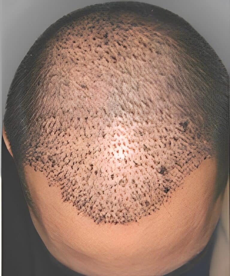 After Image: Patient 8 - front