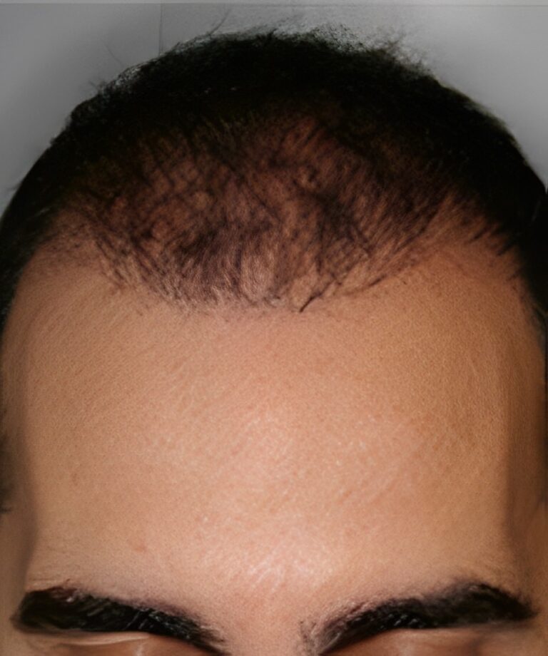 After Image: Patient 8 - front