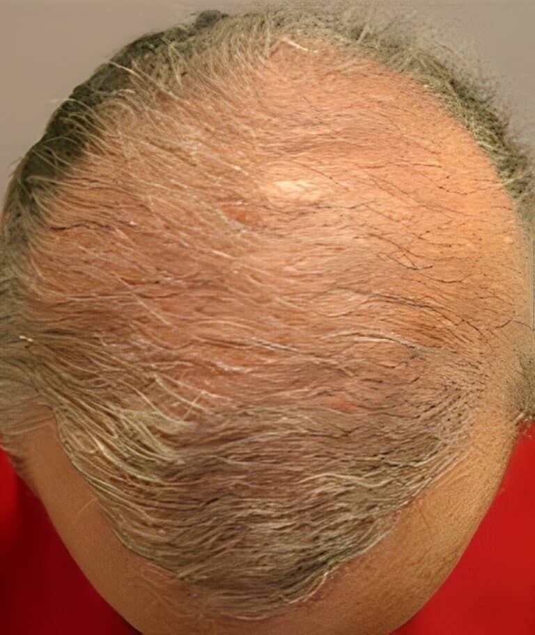 After Image: Patient 9 - front