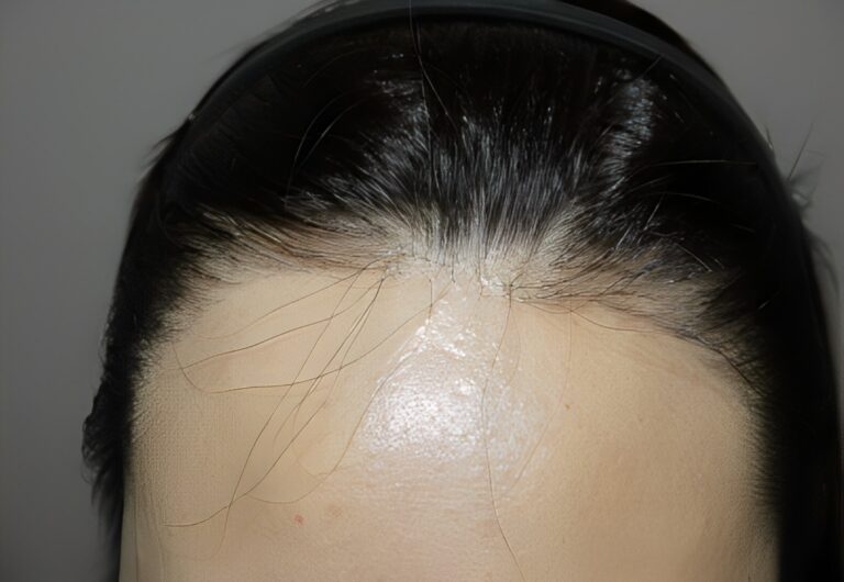After Image: Patient 3 - front