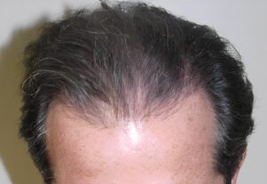 After Image: Patient 4